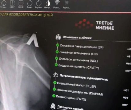 В Турках введён в эксплуатацию современный рентгенаппарат